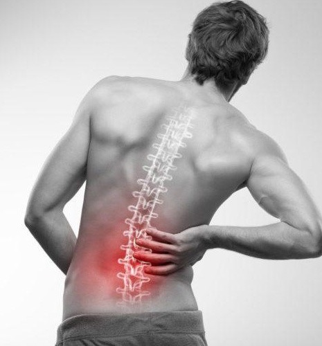 Back pain physiotherapy