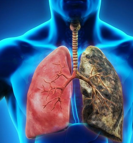 Respiratory conditions