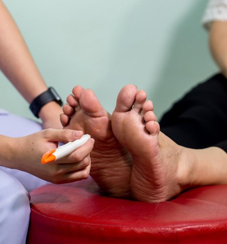 Diabetic foot & neuropathy