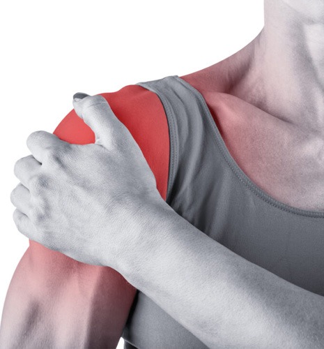  Frozen Shoulder